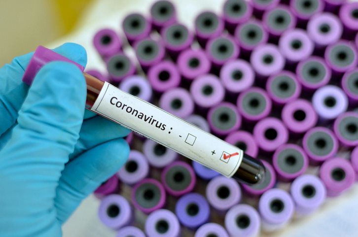 Coronavirus: Peste 20 de milioane de cazuri în lume, bilanţ dublu faţă de cel din urmă cu 45 de zile